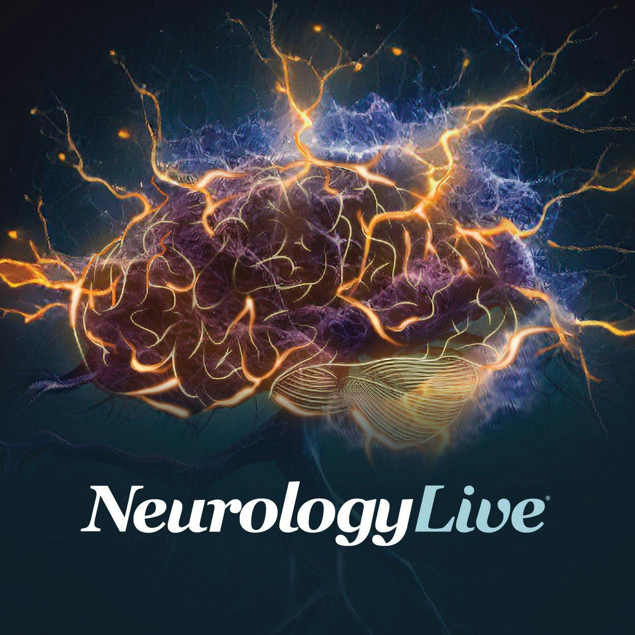 Serum Neurofilament Light Adds Complimentary Value to Monitoring Disease Progression in Relapsing Multiple Sclerosis